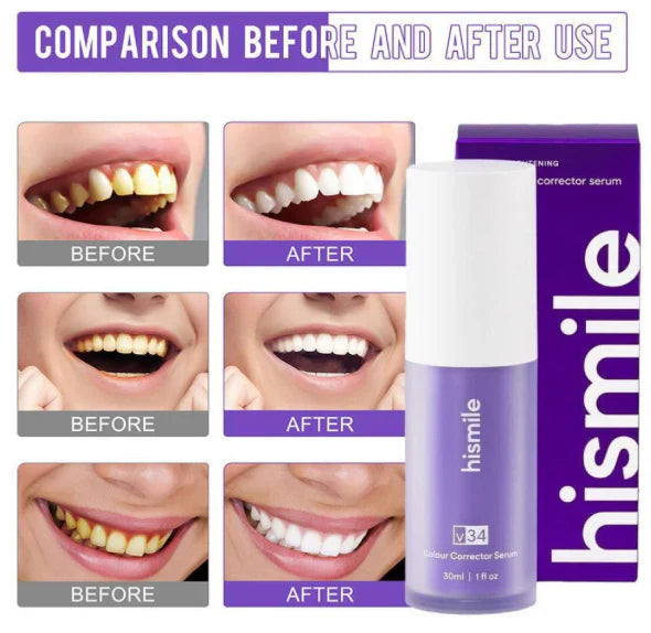 100% Original Hi Smile Teeth Whitening Serum V34 Without Sensitivity
