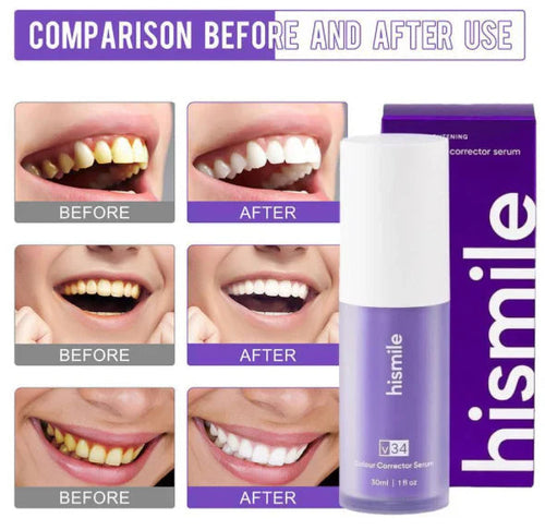 100% Original Hi Smile Teeth Whitening Serum V34 Without Sensitivity